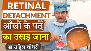 Retinal Detachment  आँख के पर्दे का अपनी जगह से हट जाना  Cause Symptoms Diagnosis and Treatment [upl. by Atinniuq862]