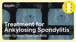 Treatment for Ankylosing Spondylitis New Options That Can Help  GoodRx [upl. by Bettine]