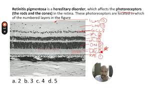 Which layer of the retina is RP affected  NEETNEXT [upl. by Negaem]