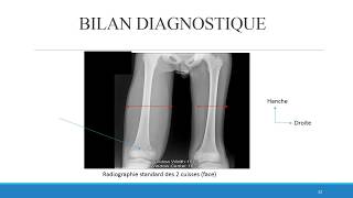 OSTEOMYELITE du STAFF vid [upl. by Slavic]