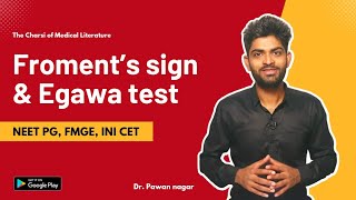 Froments sign and Egawa test  FMGE NEET PG INICET [upl. by Ahsenwahs937]