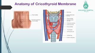 Cricothyroidotomy [upl. by Rasecoiluj]