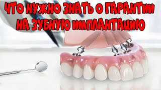 Гарантии на зубную имплантацию [upl. by Chase]