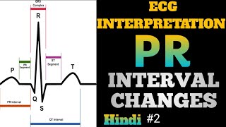 ECG interpretation in hindi  how to read ecg in hindi  PR interval Changes interpretation  2 [upl. by Annoel]