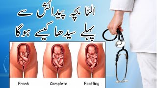 How to turn breech baby into head down  Ulta bacha sidha Drmrssaeed [upl. by Klement]