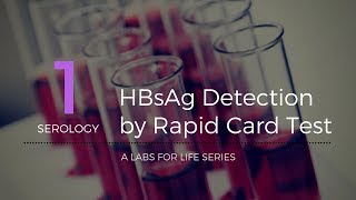 HBsAg Detection by Rapid Card Test [upl. by Hgalehs]