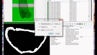 Cortical bone 1 periosteal and endosteal parameters [upl. by Aneloaup934]