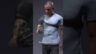 How Bionic Arm Works [upl. by Ydnamron578]