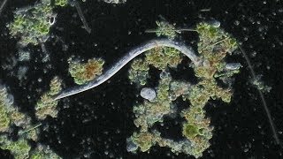 Nematodes Under Microscope [upl. by Handel]