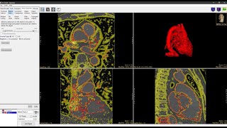 Analyze 150  Segment Edge Strength [upl. by Artinahs394]