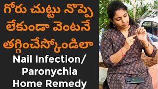 గోరు చుట్టుGoru Chuttu Home RemedyNail Infection treatment at homeParonychiaBest Remedy telugu [upl. by Yob]