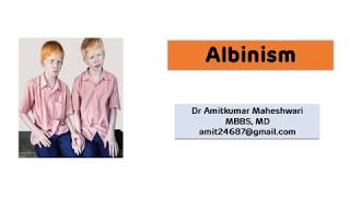 Albinism  Deficiency of Tyrosinase [upl. by Bonnell507]