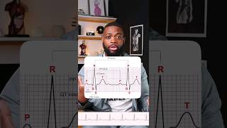 Normal Sinus Rhythm Explained ecg ecginterpretation sinusrhythm [upl. by Ricky]