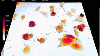 Cellular apoptosis imaged by holographic microscopy [upl. by Kaiser]