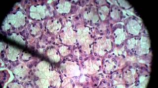 Mucus Acini Glanduar Epithelium [upl. by Hars]