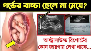 আল্ট্রাসাউন্ড রিপোর্ট দেখে কিভাবে বুঝবেন গর্ভের বাচ্চা ছেলে না মেয়ে  আল্ট্রাসনোগ্রাফি রিপোর্ট [upl. by Magill]