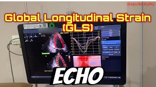 How to obtain global longitudinal strain echocardiography  tutorial [upl. by Cusack]