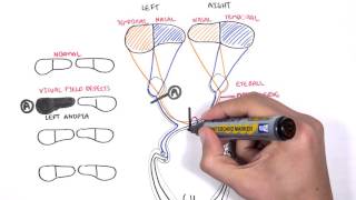 Visual Pathway and Lesions [upl. by Suedama302]