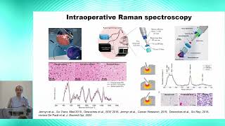 8th BigBrain Workshop 2024 Labelfree biomolecular tissue analysis in the living brain via [upl. by Imray411]