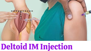 How to give Deltoid Intramuscular IM Injection in shoulder Muscle easily at home [upl. by Nona844]