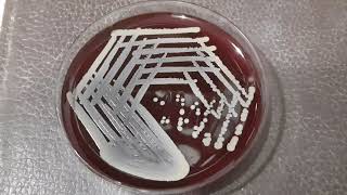 Betahaemolytic colonies of Staphylococcus aureus on blood agar Demonstration [upl. by Reni]