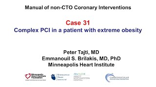 Case 31 PCI Manual  PCI and extreme obesity [upl. by Losiram481]