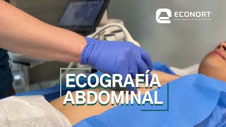 Ecografía Abdominal Antofagasta  ECONORT [upl. by Atsyrc]