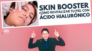 SKIN BOOSTER COMO REVITALIZAR LA PIEL CON ACIDO HIALURONICO  DR MARINO DERMATOLOGO [upl. by Franklyn]