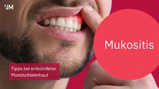 Mukositis Tipps bei entzündeter Mundschleimhaut durch die Krebstherapie [upl. by Ablem921]