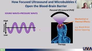 Focused Ultrasound with Delaney Fisher [upl. by Anatnas911]