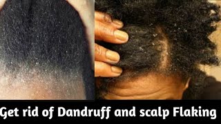 Damatol  Best amp Cheap Treatment For DandruffFlaky Scalp Watch How To Use It [upl. by Ev]