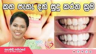 Ape Miss  දත් සුදු කරන්න ස්වාභාවික පිලියම්  Shyamalee Pathirage [upl. by Rasecoiluj]