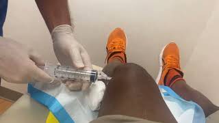 Cortisone What does the knee injection look like [upl. by Aisats]