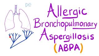 Allergic Bronchopulmonary Aspergillosis ABPA  Asthma Cough Eosinophils  Lungs [upl. by Uchish]