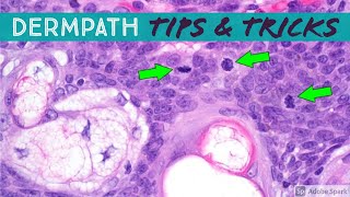 Dermatopathology Practical Tips amp Tricks for Pathology amp Dermatology [upl. by Terti814]