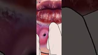 Ultimate Blackheads Remover Say Goodbye to Stubborn Pores  BeautyByte Animations [upl. by Anital159]