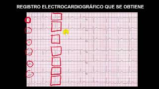 CURSO DE ELECTROCARDIOGRAFIA 08  REGISTRO ELECTROCARDIOGRÁFICO QUE SE OBTIENE [upl. by Seraphim]