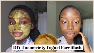 DIY Yogurt amp Turmeric Face Mask  For Hyperpigmentation amp Acne Scars [upl. by Inavoig815]