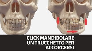 Click Mandibolare UN TRUCCHETTO UTILE [upl. by Annawot652]