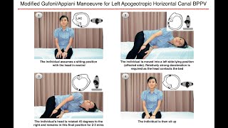 Modified GufoniAppiani Manoeuvre for Left Apogeotropic Horizontal Canal BPPV [upl. by Lindly]