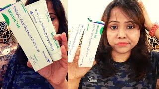 My 1 Month Experience  Salicylic Acid Ointment IP 6  SALICYLIX SF6 [upl. by Ecaidnac]