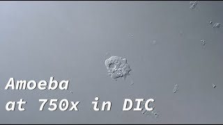 Amoeba from hay infusion  Contractile vacuole in action DIC [upl. by Brandon]