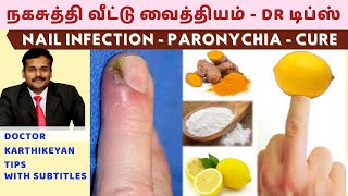 நகசுத்தி வந்தால் குணமாக வீட்டு வைத்தியம்nail skin infection home remedies paronychia dr karthikeyan [upl. by Jerold]