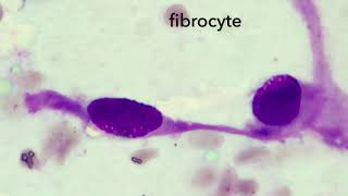 Fibrocyte morphology [upl. by Thessa]