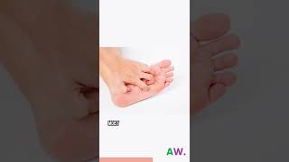 Athletes foot  Disease In A Minute EP16 [upl. by Grogan882]