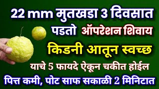 22 mm मूतखडा ३ दिवसात पडतोईडलिंबू गळलिंबू चे हे फायदे ऐकून चकित व्हालmutkhada idlimbu upay मुतखडा [upl. by Aihsek]