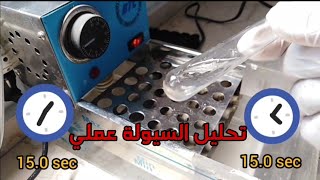 عملي البروثرومبين PT manualOpticalMagnetic [upl. by Erusaert84]