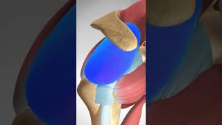 Proximal Biceps Tear Rupture and Repair biceps muscleinjury fitness [upl. by Robertson]