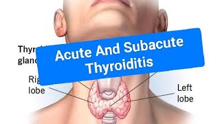 Acute and Subacute thyroiditis [upl. by Edmanda716]