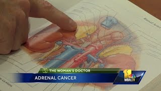 Adrenal Cancer in Women  Dr Kurtis Campbell  Mercy [upl. by Dusen]